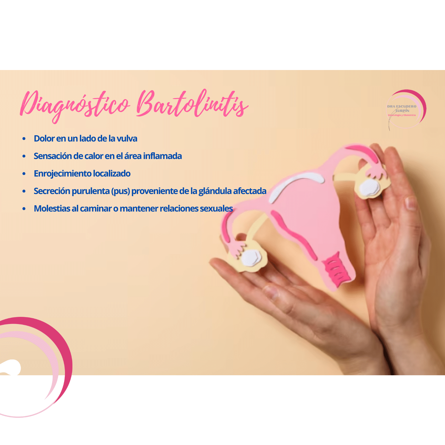 【Bartolinits: Causas, Síntomas y Tratamiento】